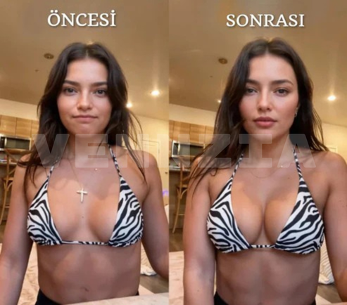 Vennzia™